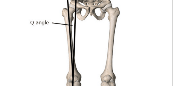 q-angle knee injury